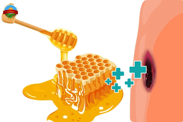 روش‌های استفاده از عسل برای کاهش ورم و بهبود زخم :