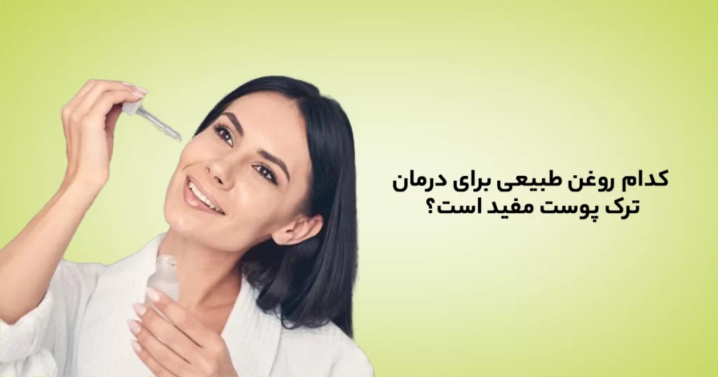 روغن های طبیعی برای درمان ترک پوستی