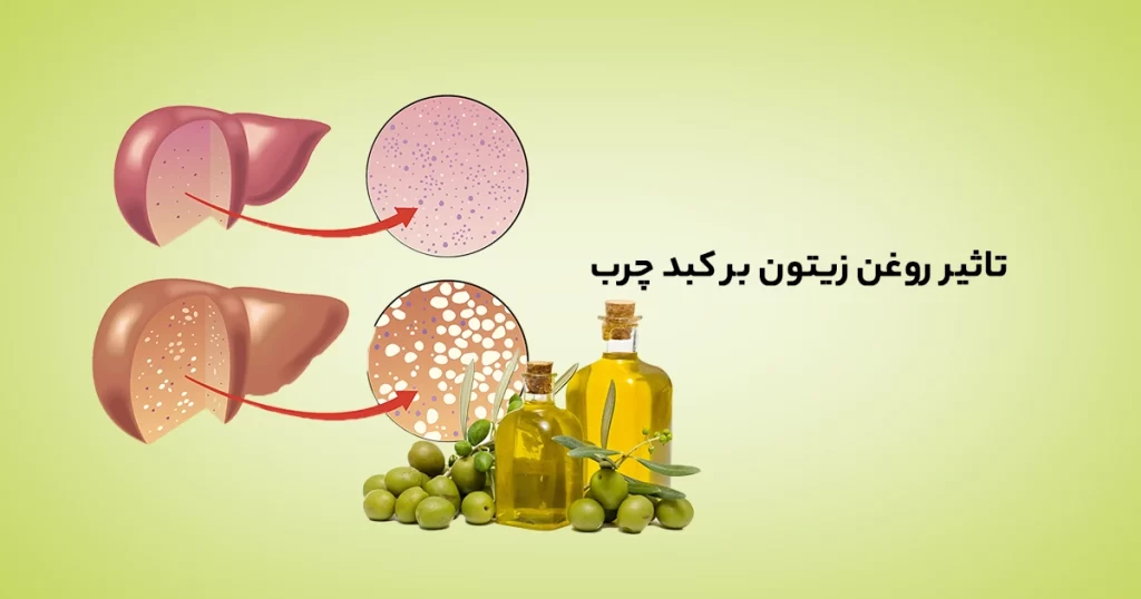 تاثیر روغن زیتون بر کبد چرب